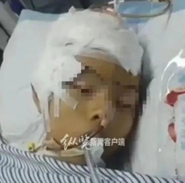 13岁少年遭霸凌致脑死亡，捐器官救7人！最新进展→