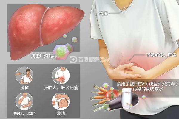 尿似“浓茶”！吃完火锅，男子得了怪病！这习惯很多人也有……