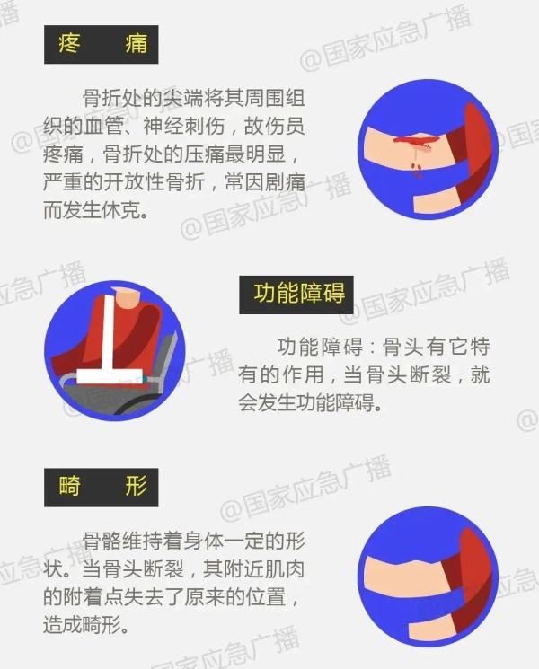 近期频发！医生紧急提醒：手再冷也别插兜