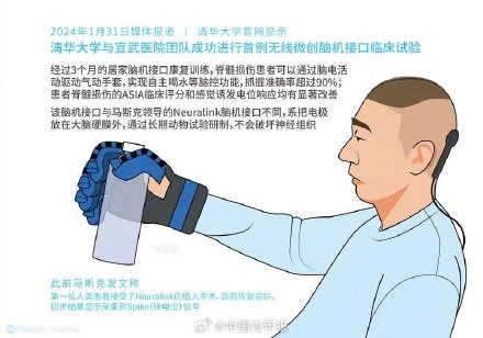 用意念握杯 脑机接口时代正在到来