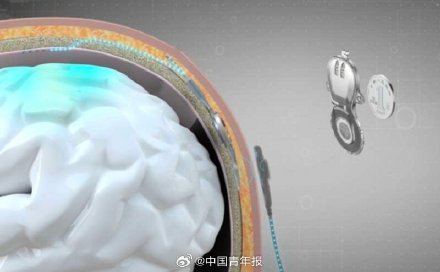 用意念握杯 脑机接口时代正在到来