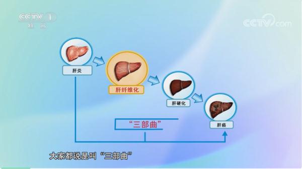 警惕！脸上出现这些症状，可能是肝脏发出的信号