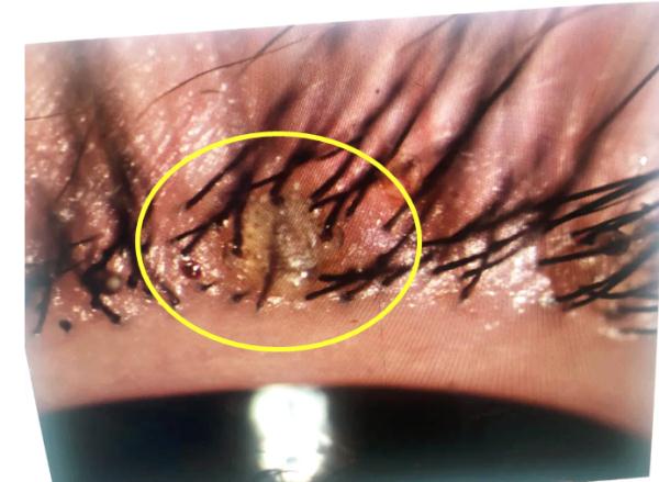 “过年三件套”爆火！但有人因此进医院…医生紧急提醒
