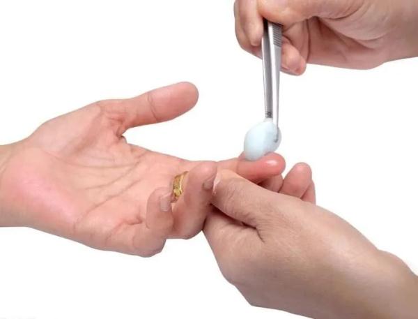 春节假期“招猫逗狗”被咬怎么办