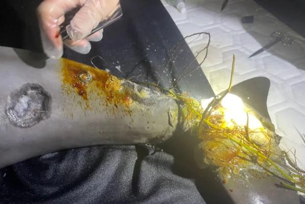 全国首例，这头江豚获救了！