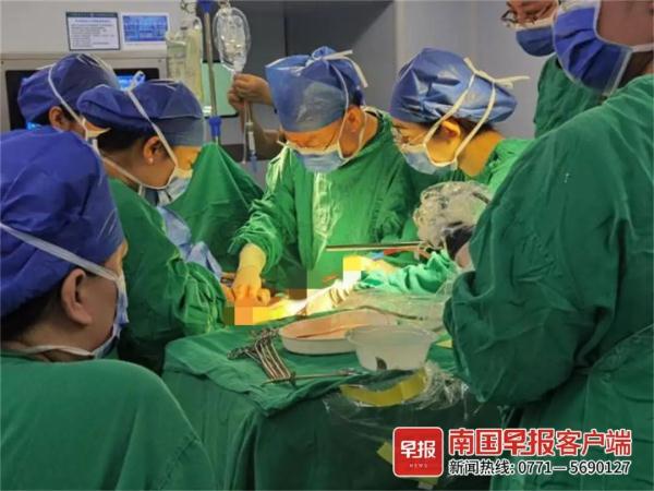 重40公斤!女子长出巨大肿瘤,医生:从业几十年没见过! 重40公斤!女子长出巨大肿瘤,医生:从业几十年没见过!