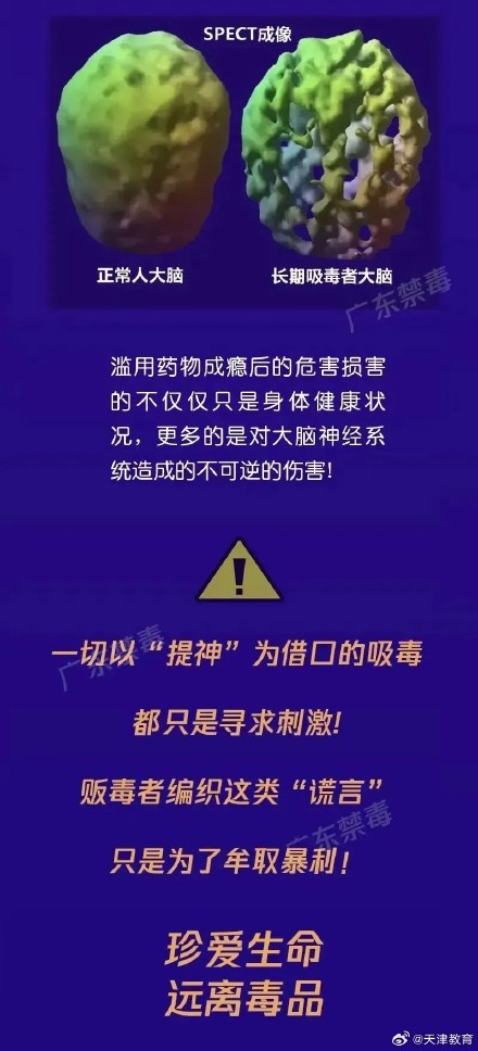 缓解“节后综合症”，这种招数使不得！