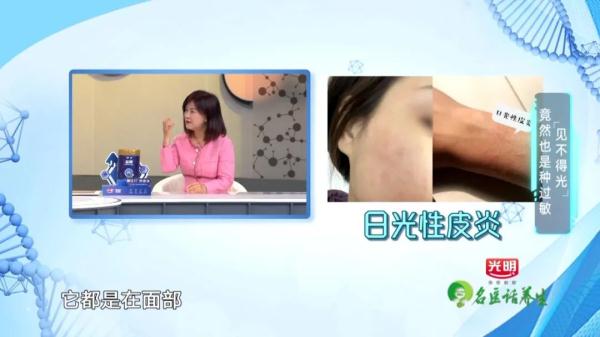 一入春就痒痒？源头不是花粉竟是这样