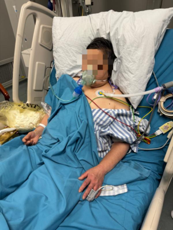 因为一只酱鸭，夫妻双双进了ICU！