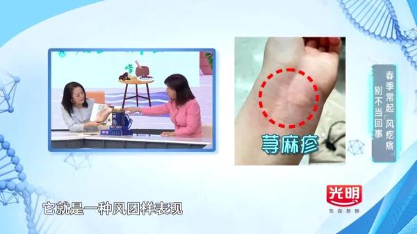 一入春就痒痒？源头不是花粉竟是这样