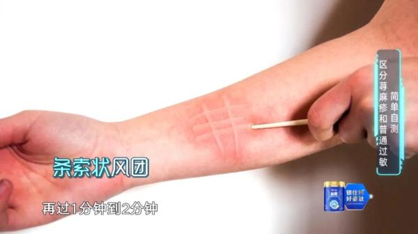 一入春就痒痒？源头不是花粉竟是这样