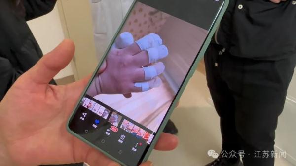 无痛觉不出汗，反复骨折啃咬手指！姐妹俩同患这种罕见病……家人崩溃