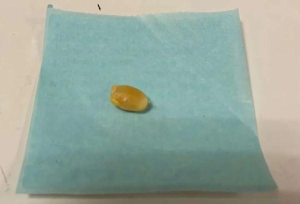 7岁孩子将黄豆塞入耳朵，三个月后已发芽……医生提醒→