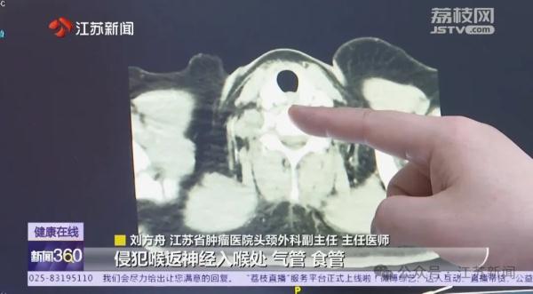 一家3口，全部确诊一种癌！