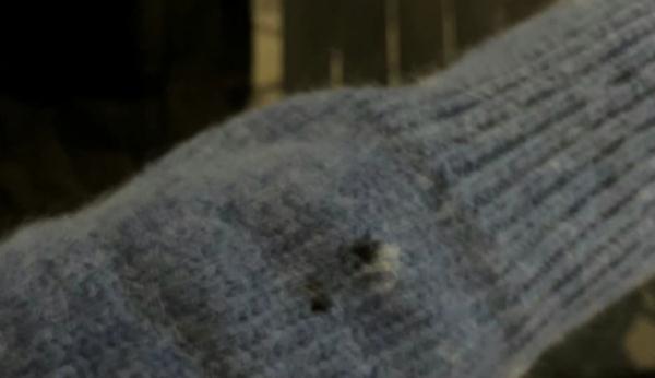 The woman saw that the skin of the iron flower was burned, and the staff: the safety scope was expanded by 200%.