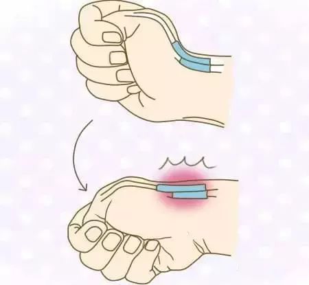 手腕疼 当心腱鞘炎 手腕疼 当心腱鞘炎