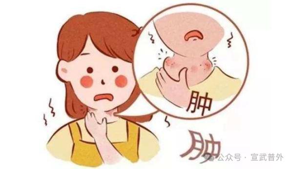 甲状腺结节,不是儿戏! 甲状腺结节,不是儿戏!