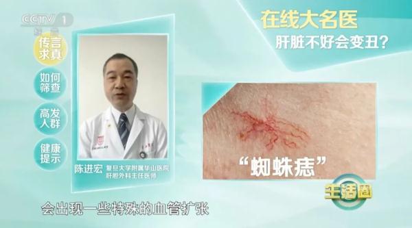 春天来了,肝不好容易显老!改掉这4个坏习惯,养肝=养命 春天来了,肝不好容易显老!改掉这4个坏习惯,养肝=养命