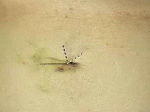 现实版“热辣滚烫”，日行7000步也能瘦？7个月减了近百斤