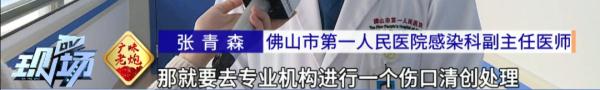 致命危“鸡”！女子被鸡啄了一下住进ICU…