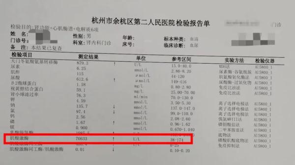 可怕！浙江20多岁小伙尿出“酱油”，超出正常值400倍