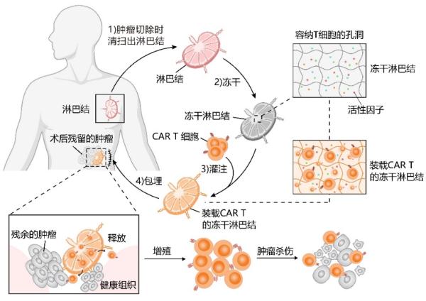 从冻干果蔬找到灵感，浙大科研团队开发肿瘤治疗新方法
