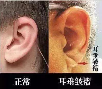 出现这6种“面相”，千万别忽视！可能存在健康问题