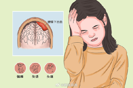 什么是硬膜下血肿