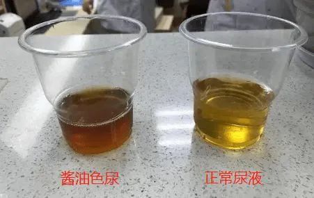 超标400多倍！小伙吓傻了，医生提醒：严重可致死，一定要量力而行