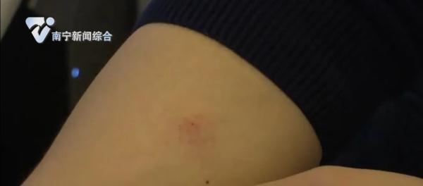 拆快递等于翻垃圾桶？女子手撕快递包装袋致过敏......
