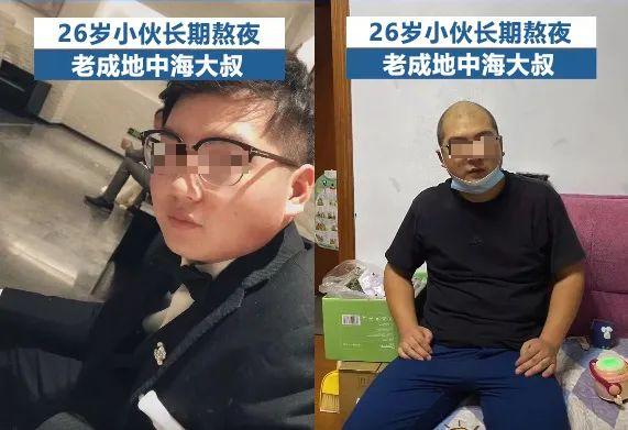 26岁男生“断崖式衰老”变大叔！这6个生活习惯一定要改