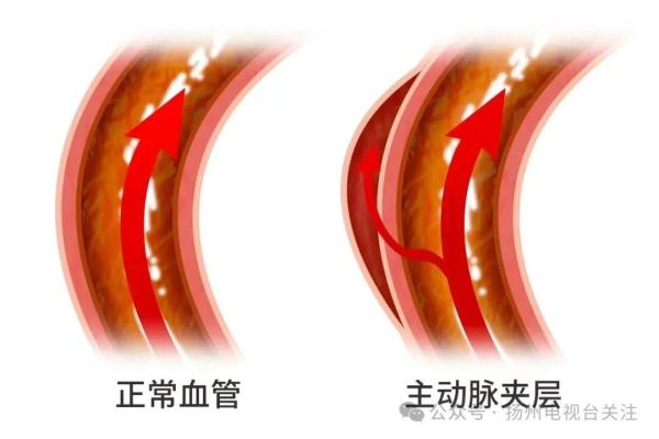 江苏29岁小伙突然胸疼被紧急送医……死亡率极高，近期警惕！