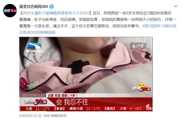 5岁女孩确诊“长发公主详细征”！医师领导：警惕这些特殊