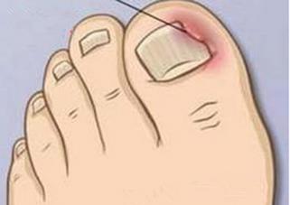 精致女孩因这个行为进医院，医生提醒