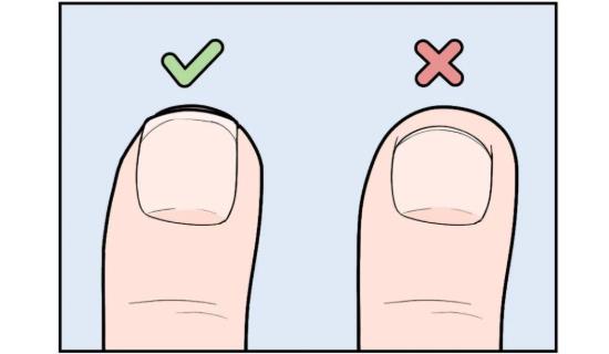 精致女孩因这个行为进医院，医生提醒