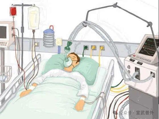 ICU为什么不能陪护? ICU为什么不能陪护?