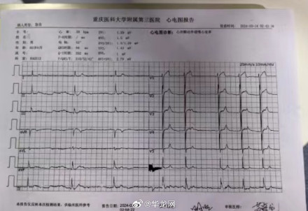 男子吃油炸蟾蜍后中毒 专家提醒：这些“夺命野味”别贪嘴