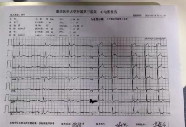 男子吃油炸蟾蜍后中毒了！专家提醒