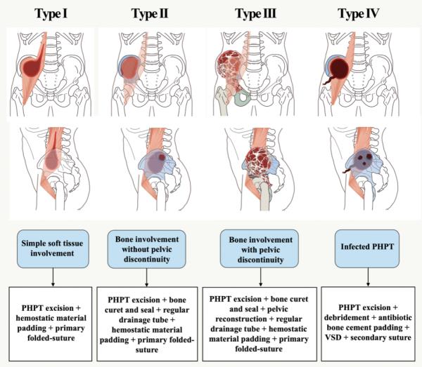 科技资讯｜研究实现单个纳米尺度物体无标记光学显微成像 等