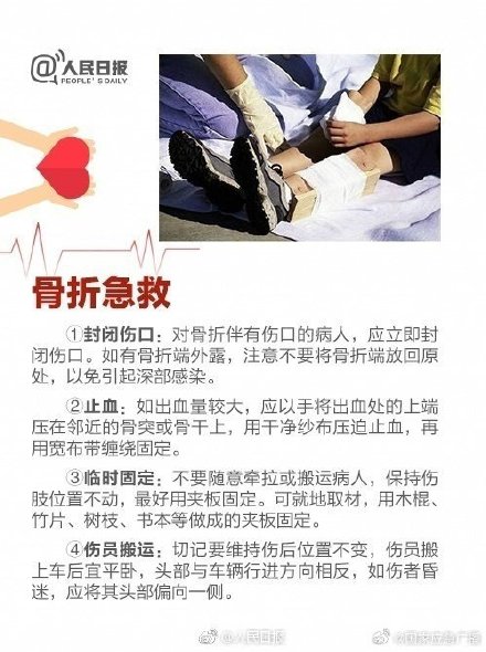 家长必备实用儿童急救方法