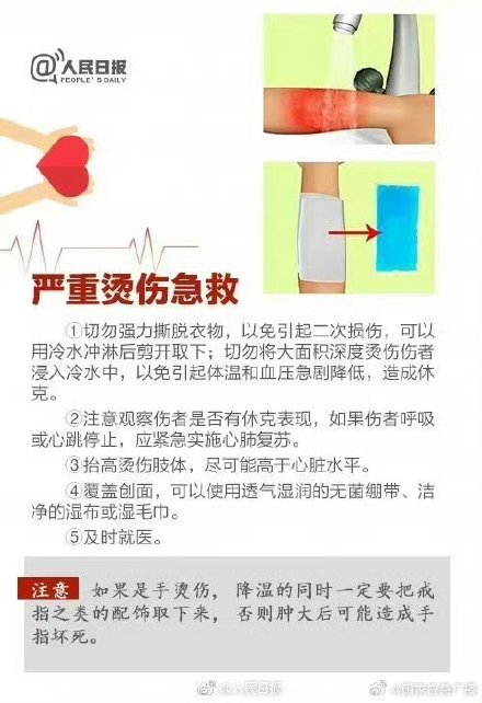 家长必备实用儿童急救方法