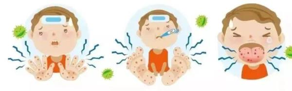 手足口病高发季来临,这份预防指南转给师生家长 手足口病高发季来临,这份预防指南转给师生家长