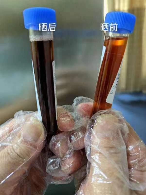 医生让95后姑娘暴晒尿液，发现竟是电视剧中的罕见病！