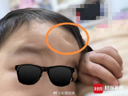 幼童摔伤致十级伤残早教机构拒绝私了:“希望走法律程序”
