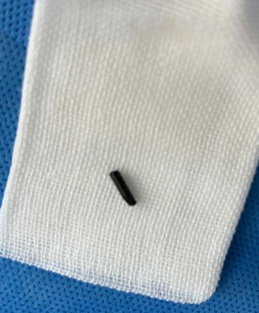 青岛一6岁男孩眼睑发炎化脓！医生竟夹出一截……家长千万注意！