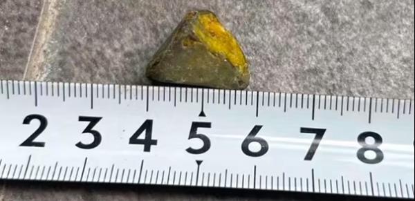 重庆一女子手术取出24颗胆结石没事盘着玩...... 重庆一女子手术取出24颗胆结石没事盘着玩......