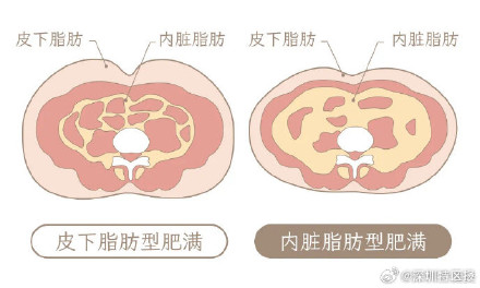 为什么肚子上的肉这么难减 为什么肚子上的肉这么难减