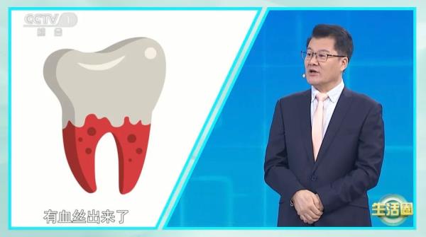 “老掉牙”是正常现象？警惕让牙齿脱落的4大“罪魁祸首”！