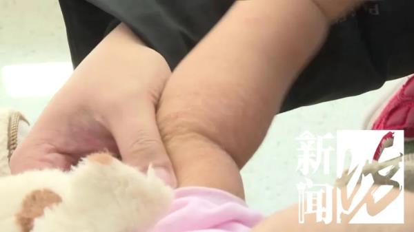 上海满大街都是！很多人都中招，甚至已经“烂脸”！这种情况严重可致命→