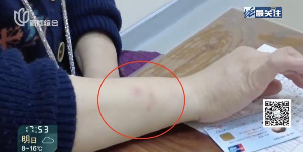上海满大街都是！很多人都中招，甚至已经“烂脸”！这种情况严重可致命→